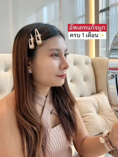 แก้จมูกใหม่