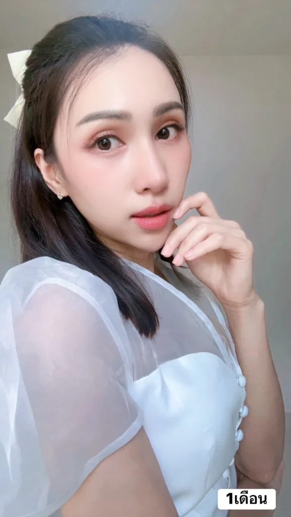 หลังแก้จมูก