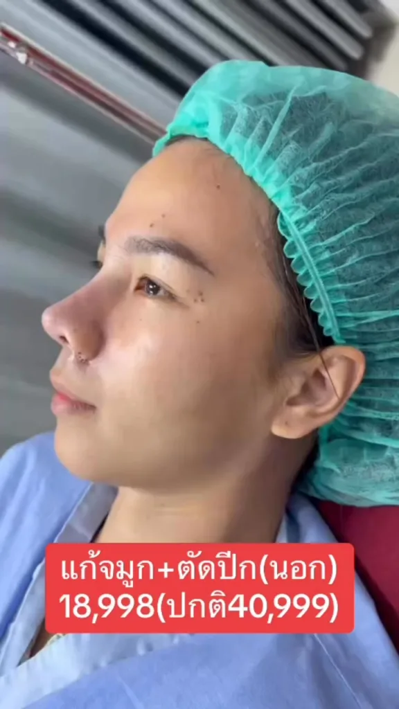 รีวิวแก้จมูก