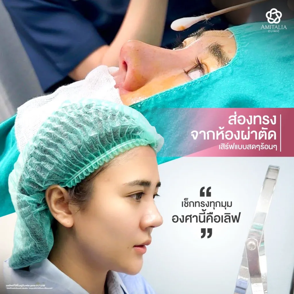 ทรงจมูก