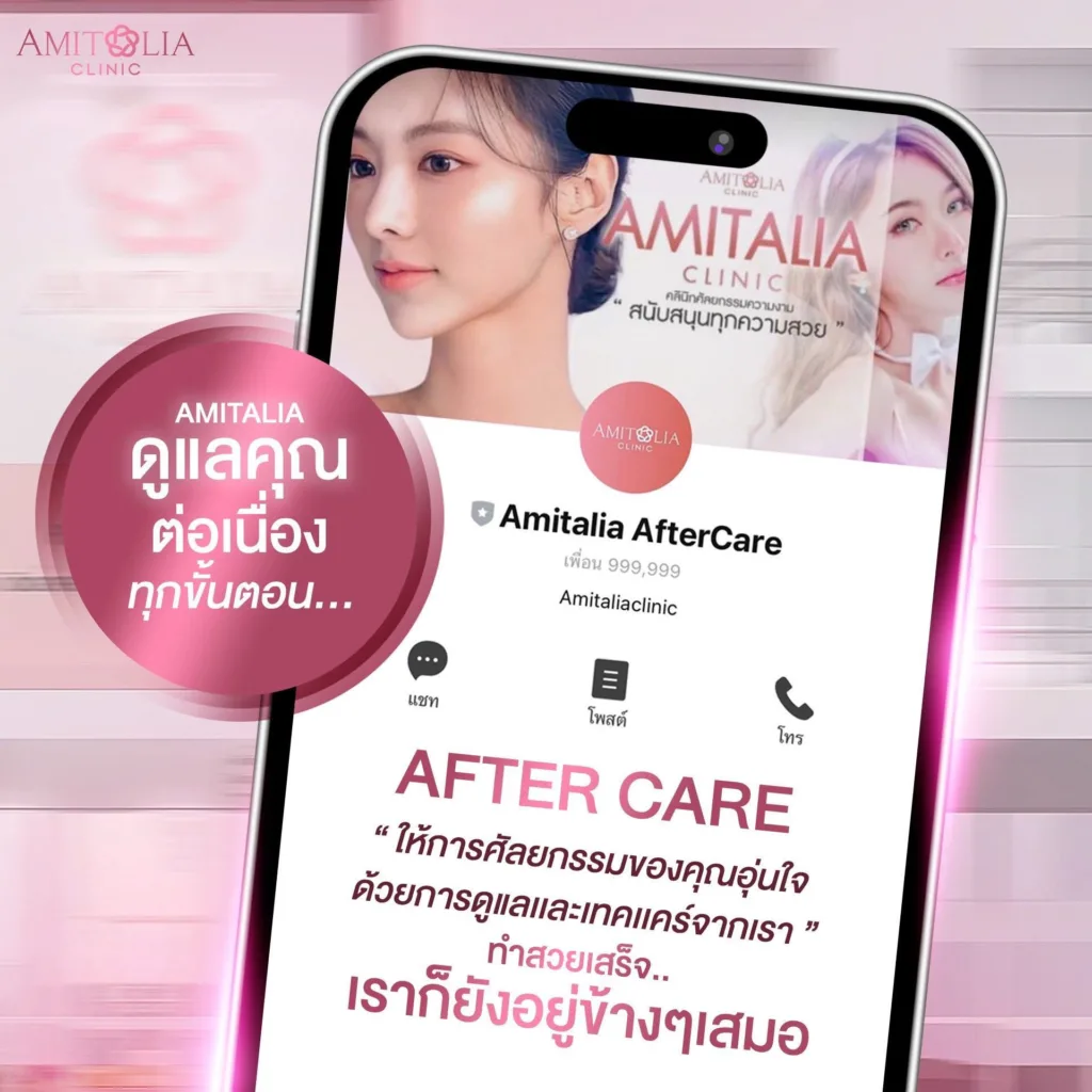 ดูแลหลังทำ