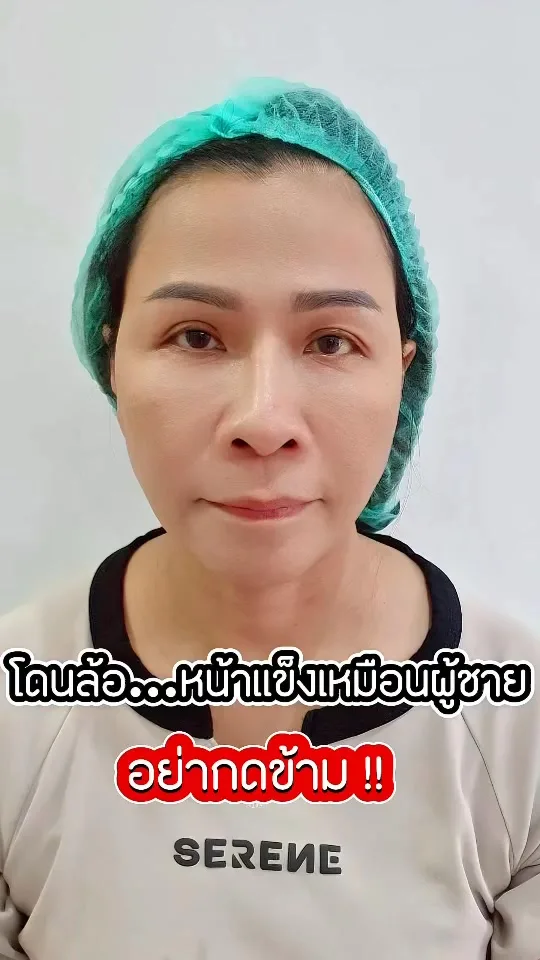 แก้จมูกเสร็จ