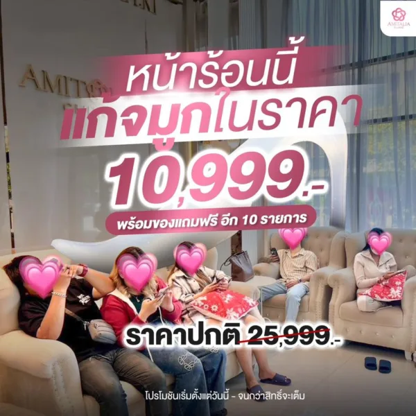 โปรโมชันแก้จมูก