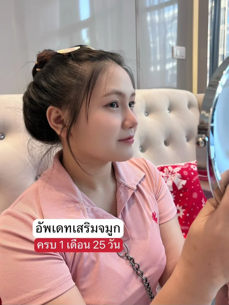 เสริมจมูกใหม่