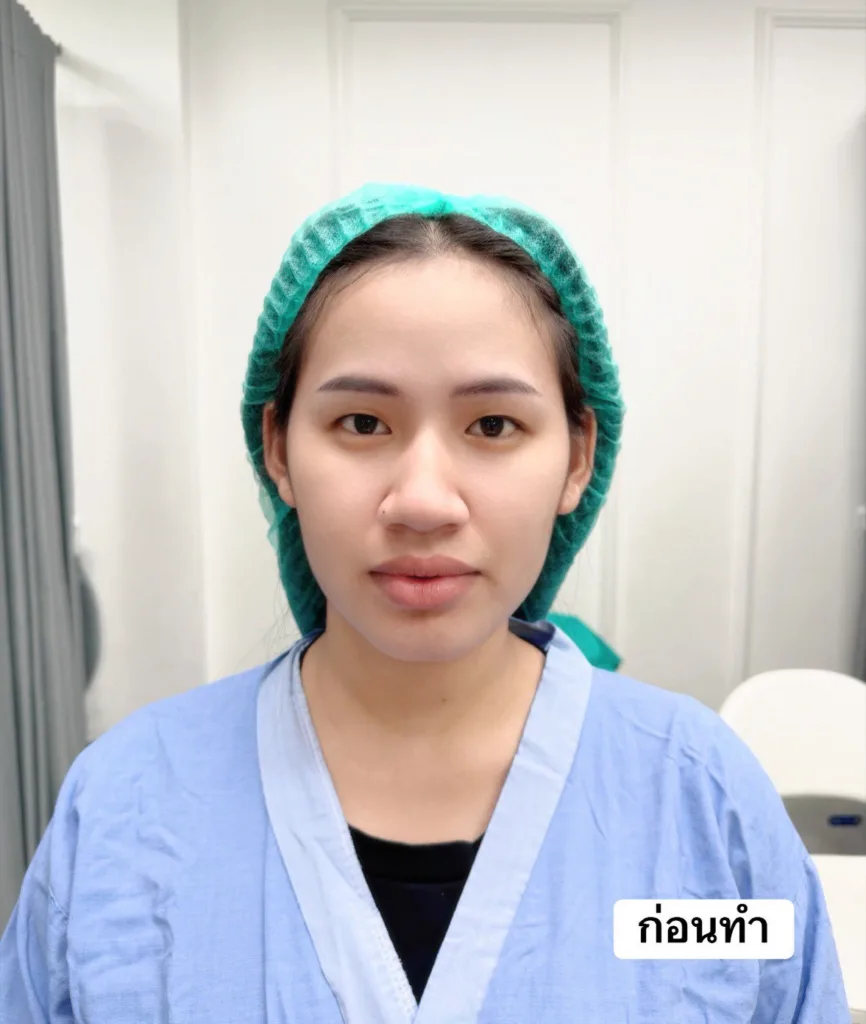 ทำตาสองชั้น