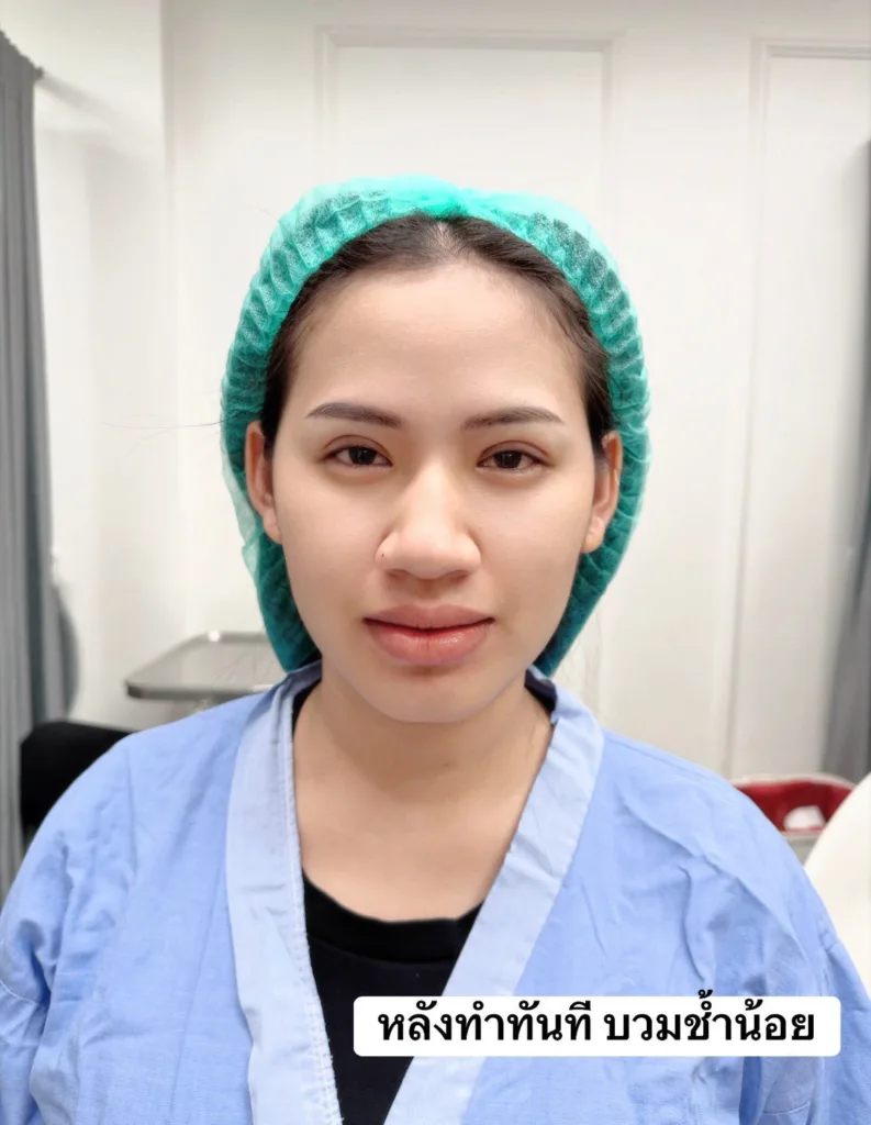 ทำตาสองชั้น