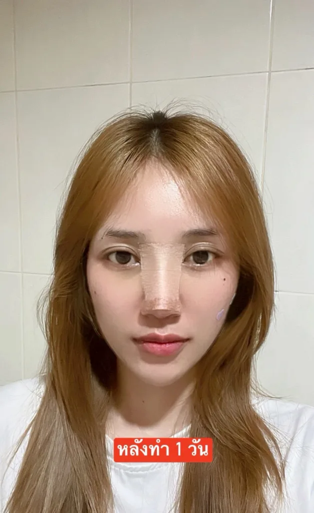 รีวิวจมูก