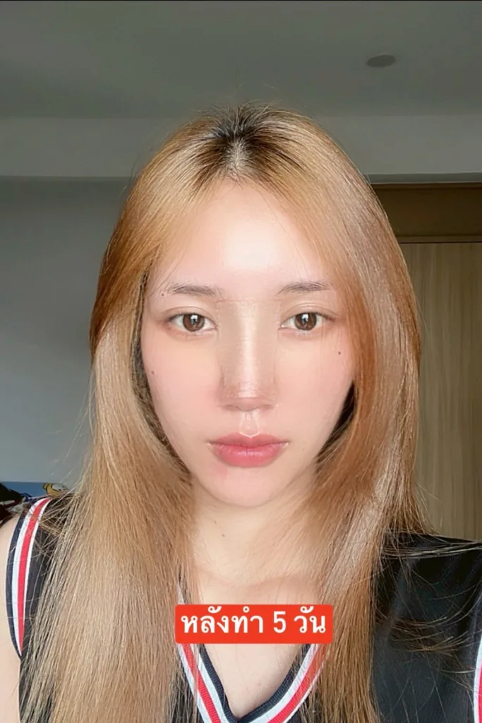 รีวิวจมูก