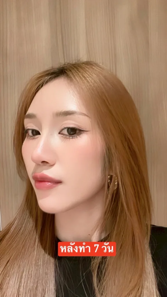 รีวิวจมูก