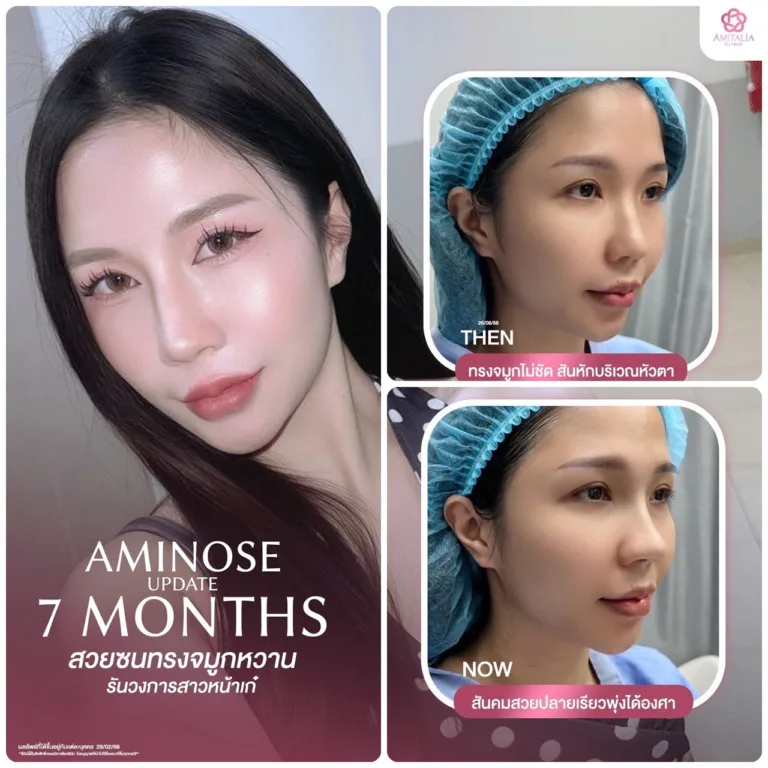 จมูกที่สวย