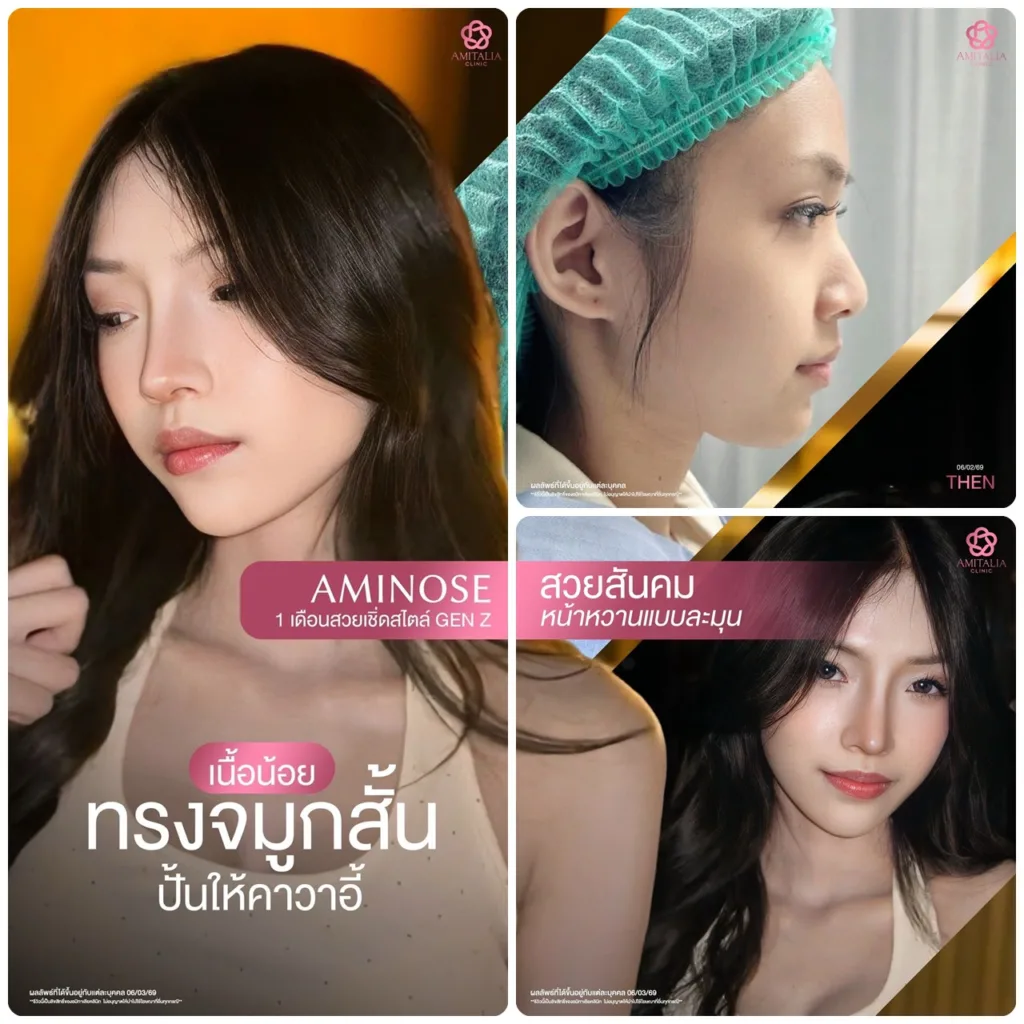 จมูกสั้น