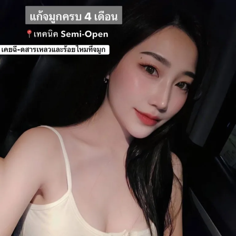 แก้จมูก