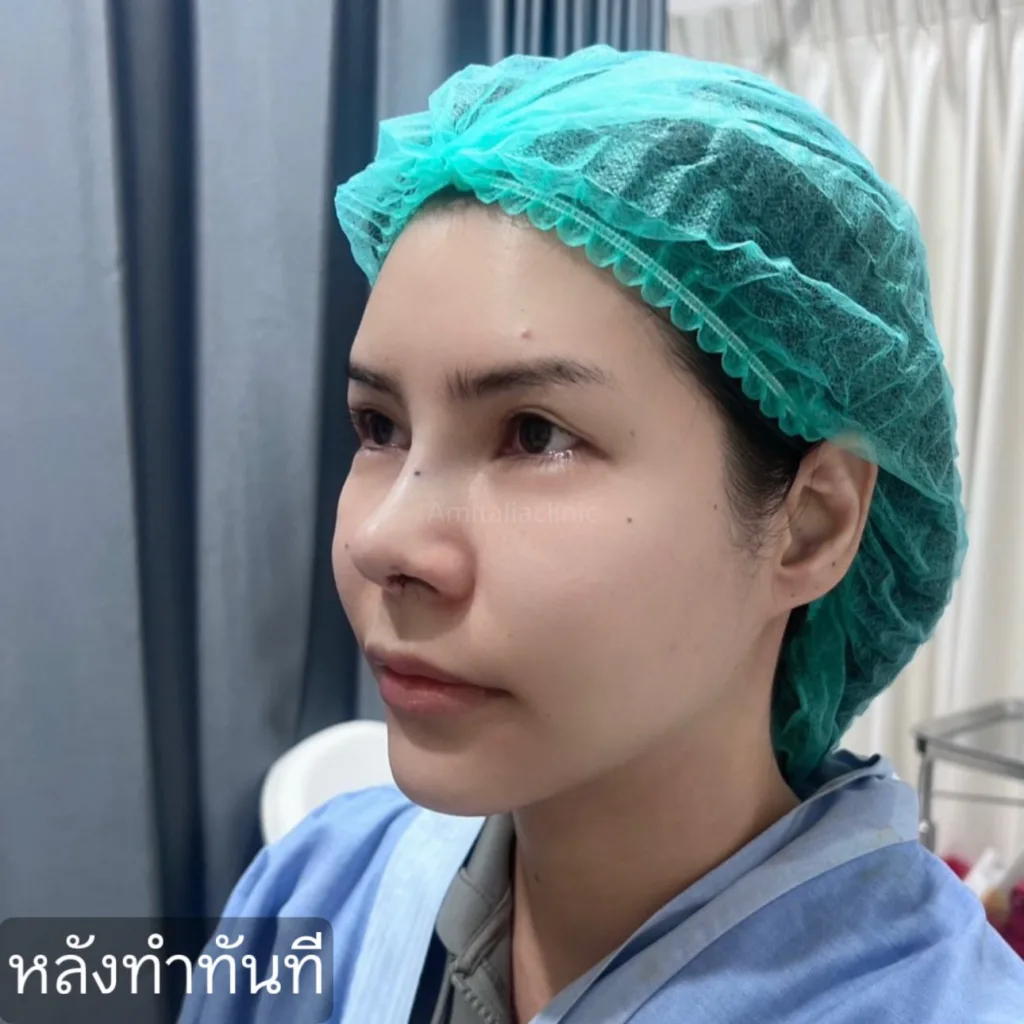 แก้จมูก