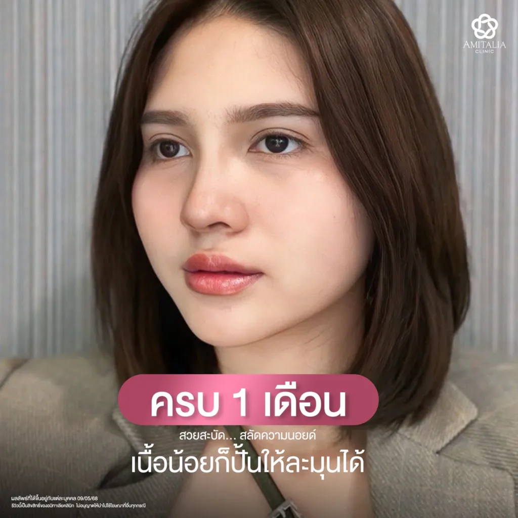 จมูกทรงสโลป
