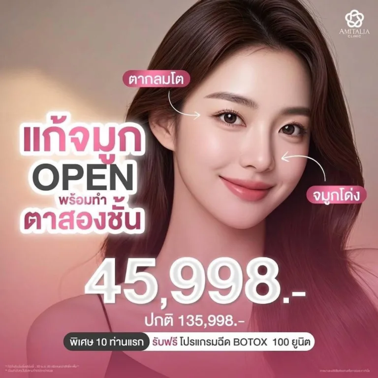 แก้จมูกด้วยเทคนิคโอเพ่น