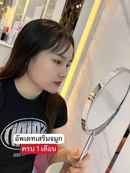 เสริมจมูกครั้งแรก