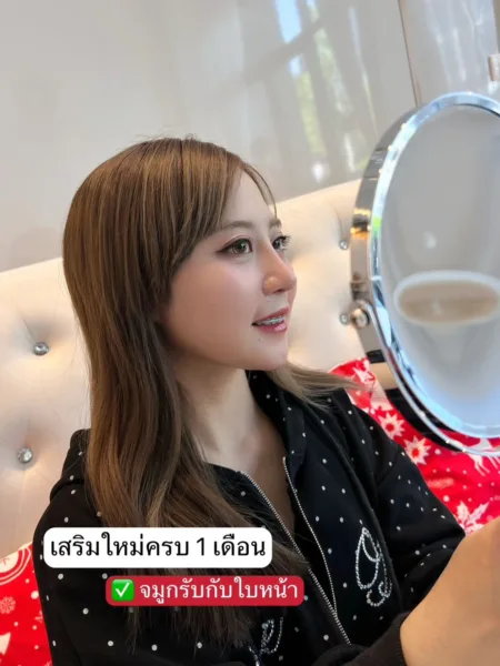 เสริมจมูกครั้งแรก