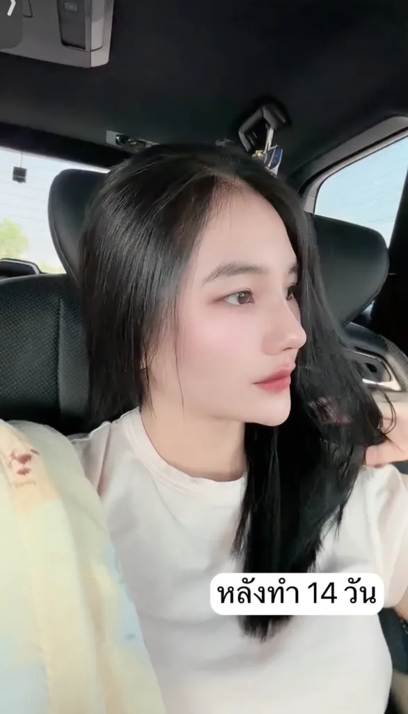 ทำจมูก