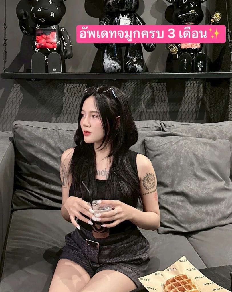 เสริมจมูก
