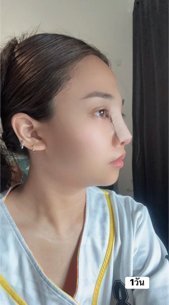 จมูกลอย