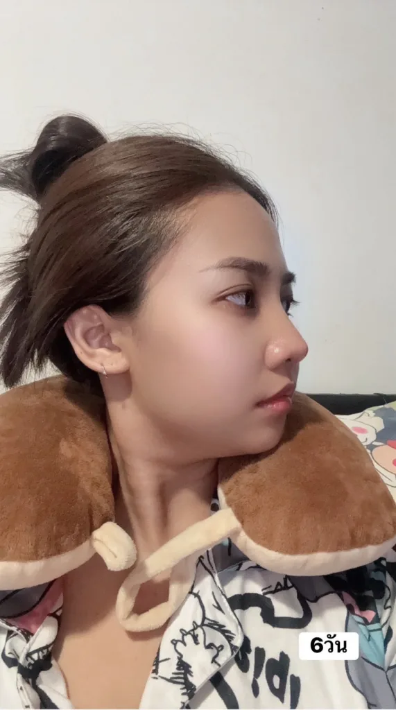 จมูกลอย