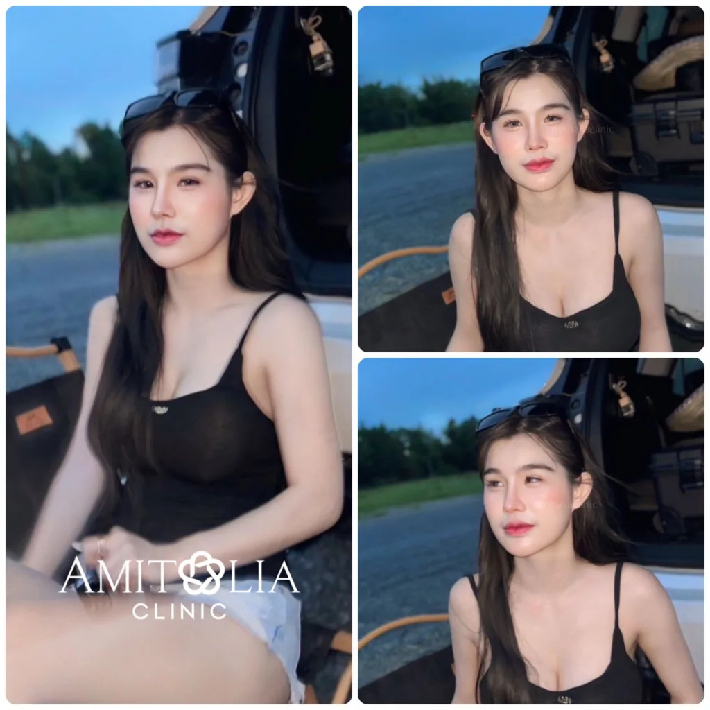 รีวิวทรงจมูก