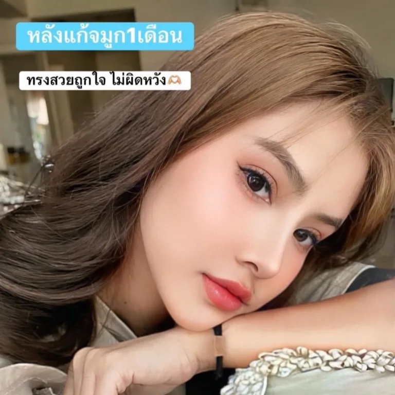 แก้จมูก