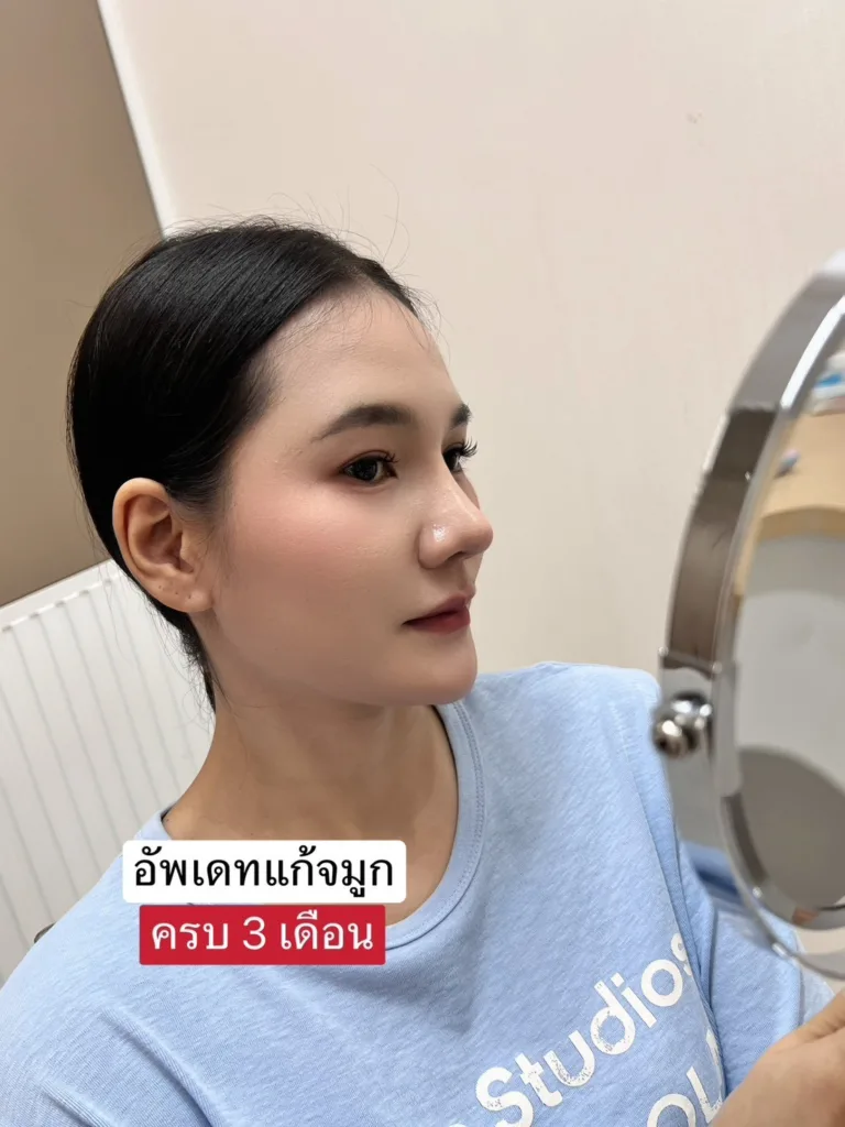 แก้จมูก