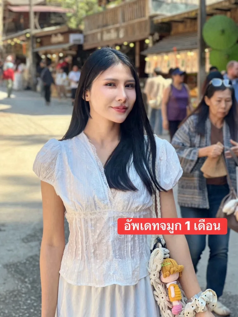 เสริมจมูก
