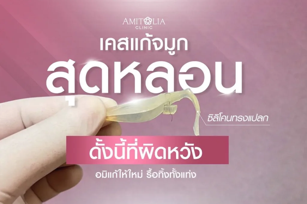 แก้จมูกใหม่