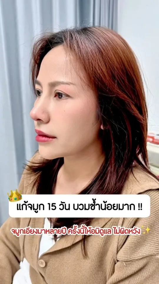 แก้จมูก