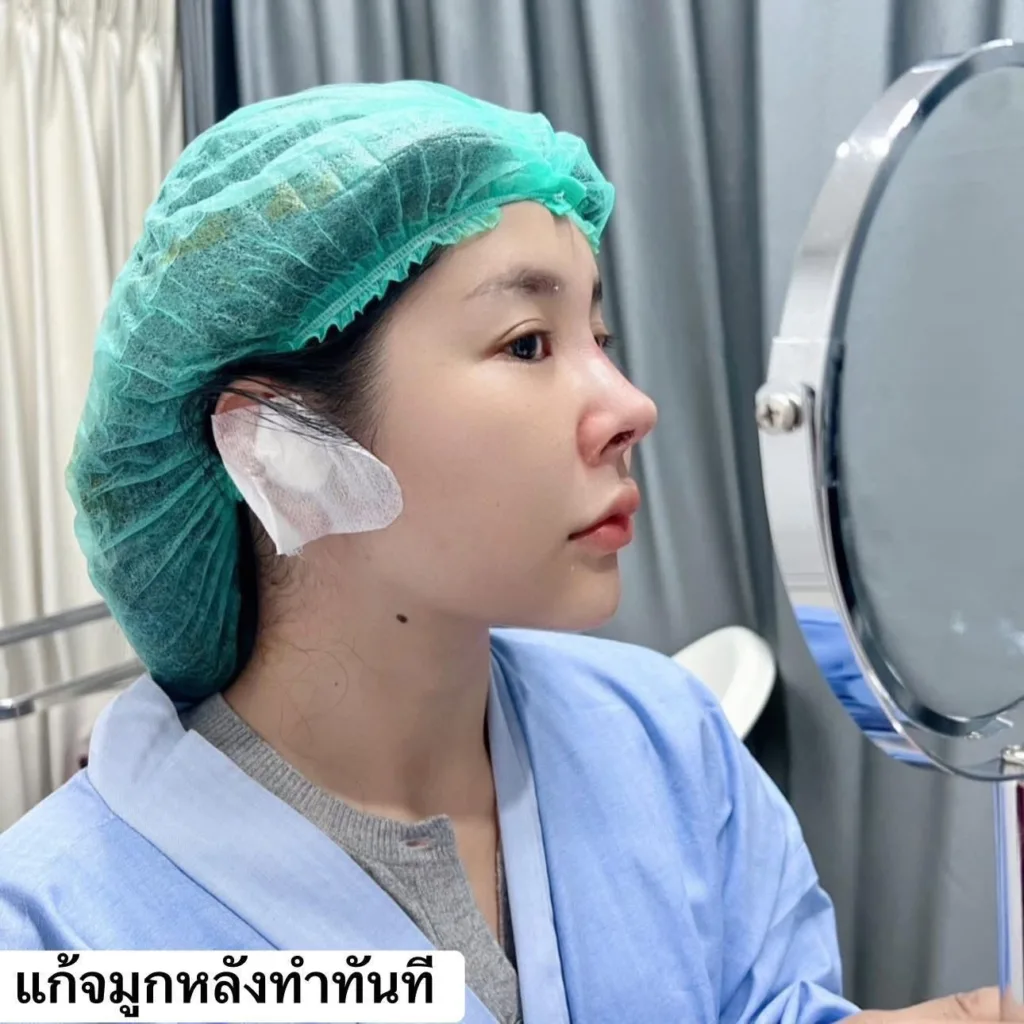 รีวิวแก้จมูก