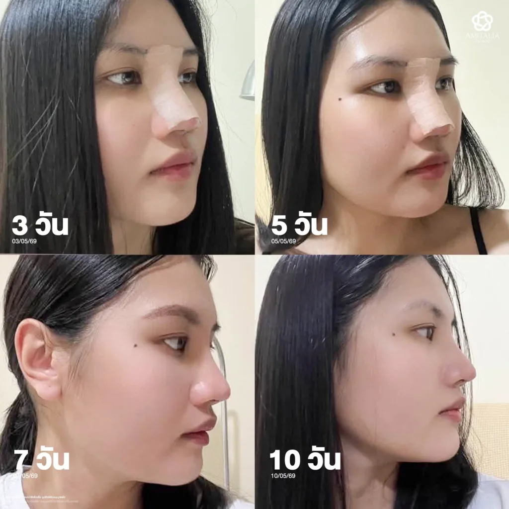 ใบหน้าดูแข็ง