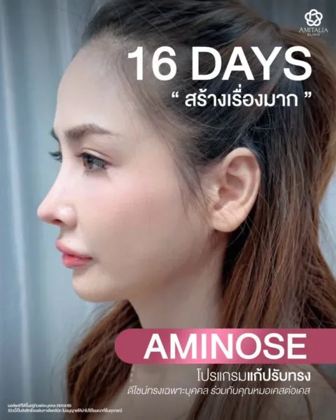 จมูกใหม่
