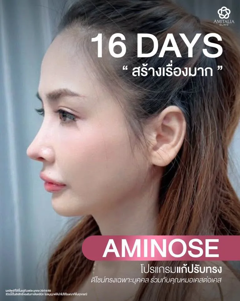 จมูกใหม่