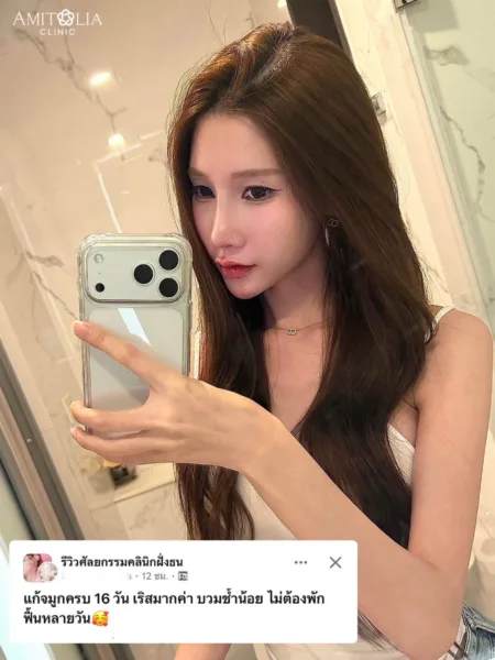 รีวิวแก้จมูก