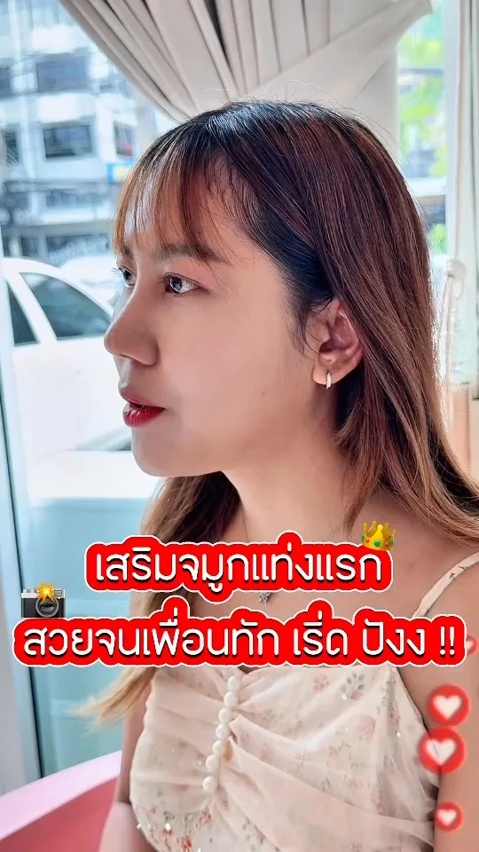 เสริมจมูกครั้งแรก
