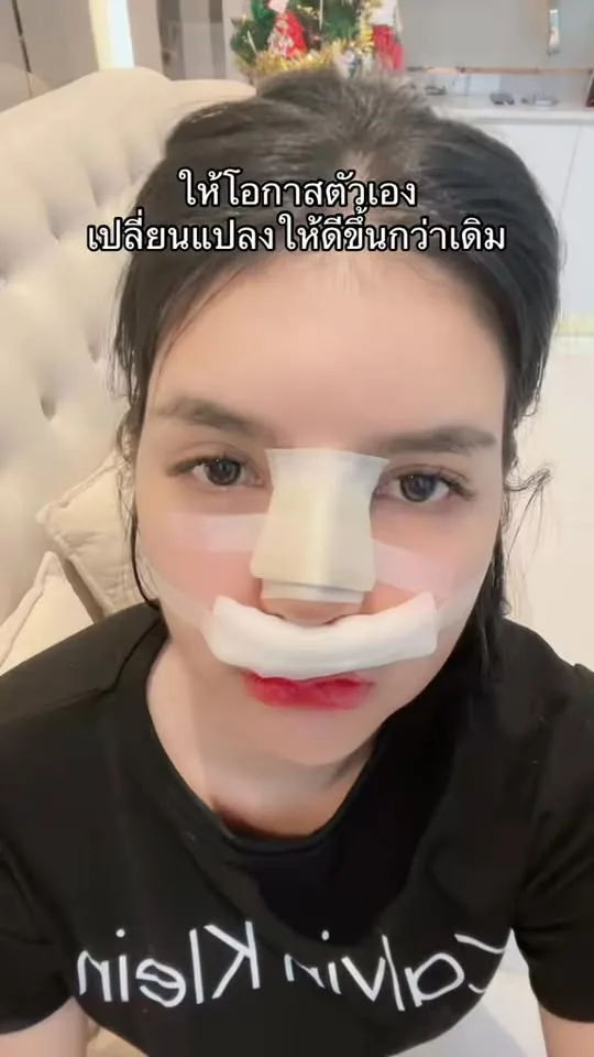 รีวิวแก้จมูก