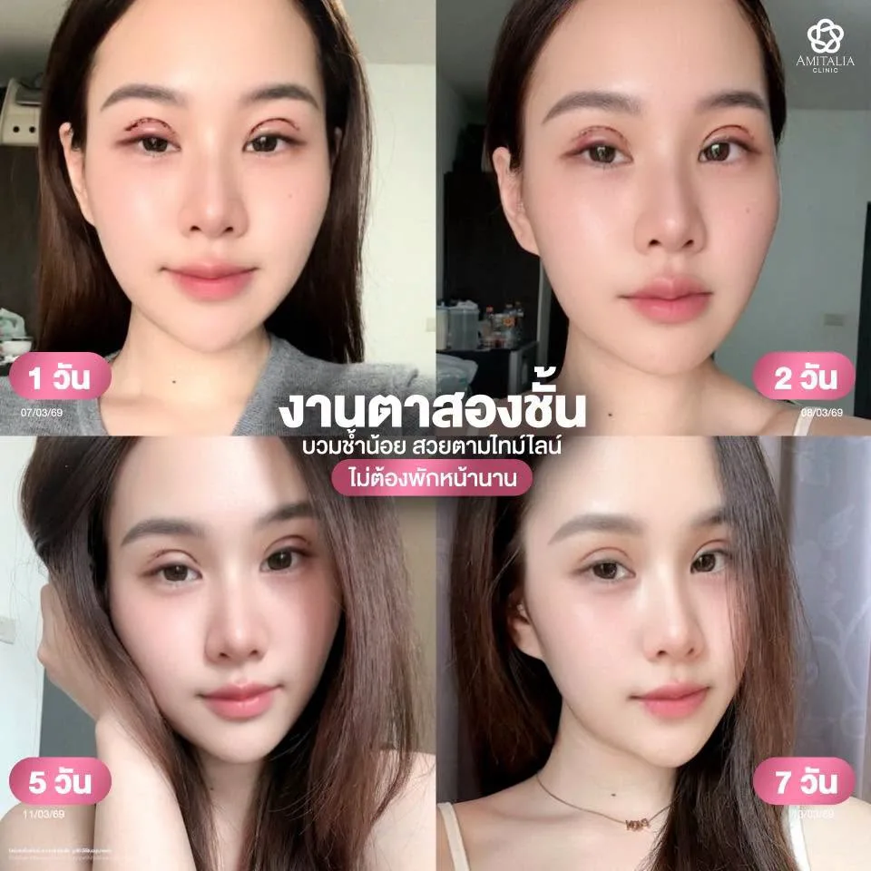 ตาสองชั้น