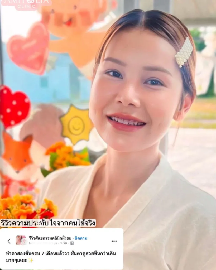 อัพเดทรีวิวตาสองชั้น