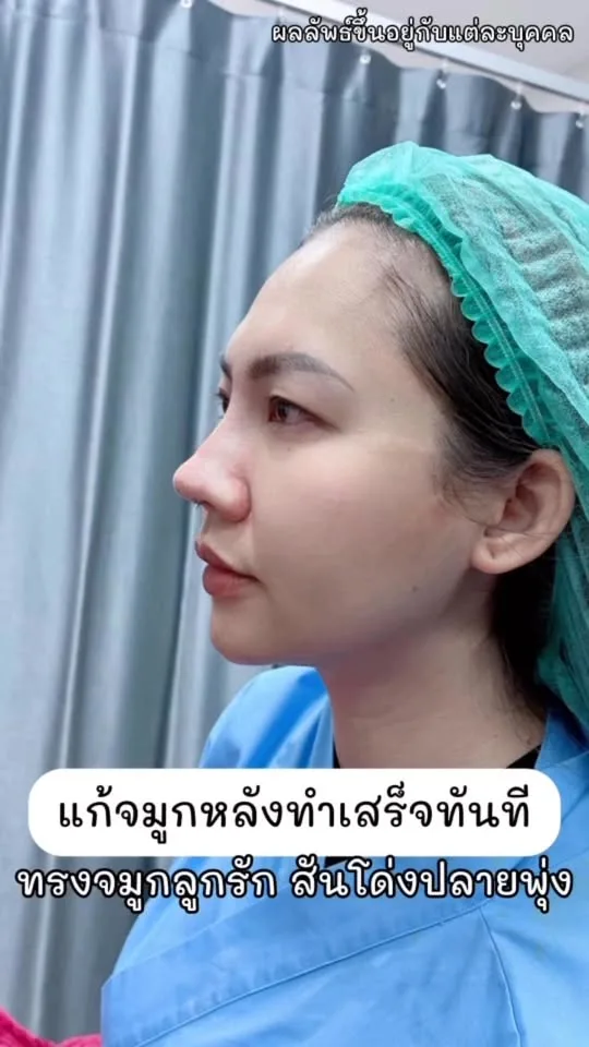เห็นทรงจมูกก่อน