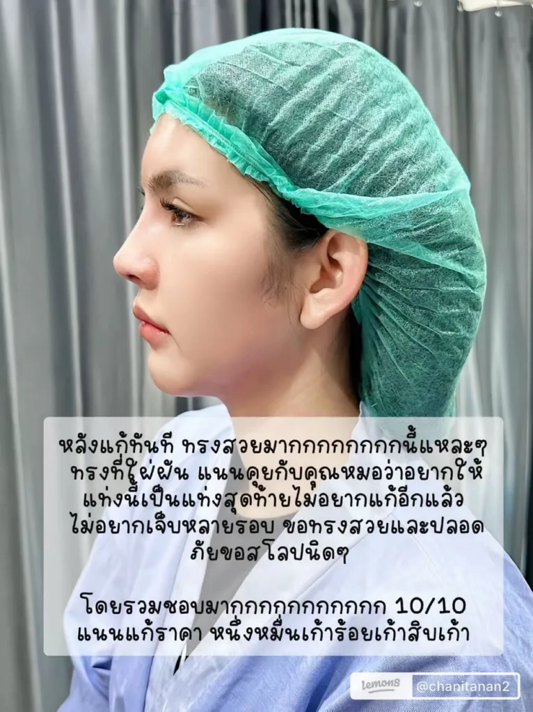 ศัลยกรรมแก้จมูก