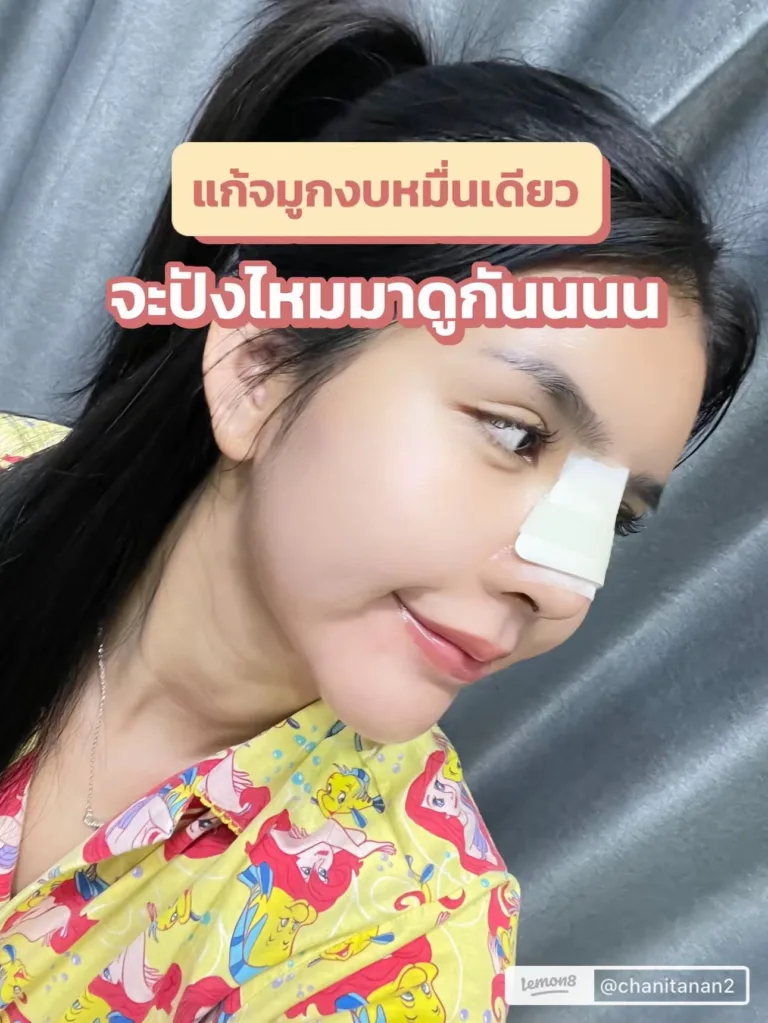 ศัลยกรรมแก้จมูก