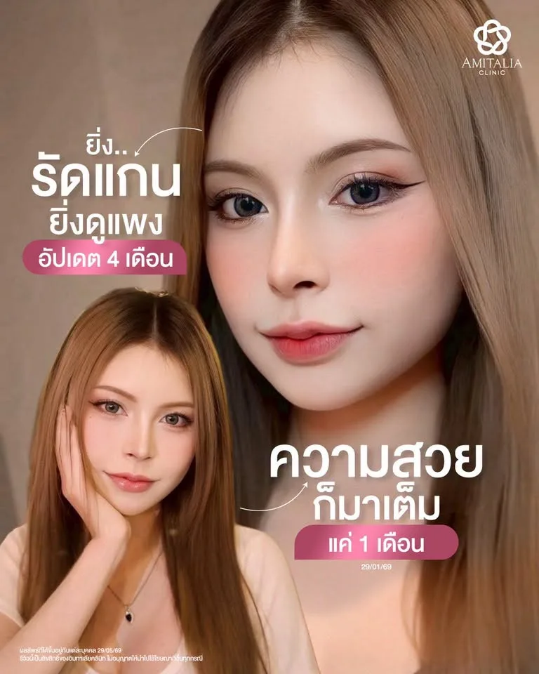 จมูกทรงลูกคุณหนู