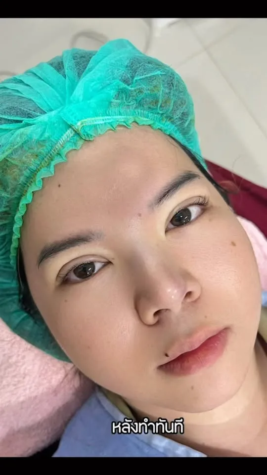 รีวิวตาสองชั้น