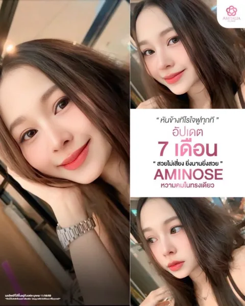 ทรงจมูกหวาน