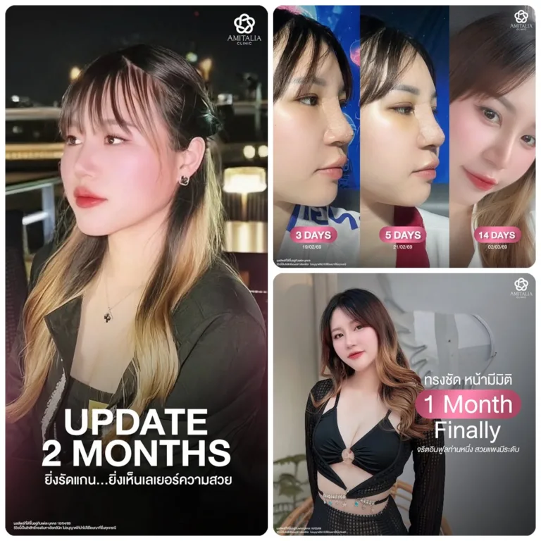 จมูกเก่า