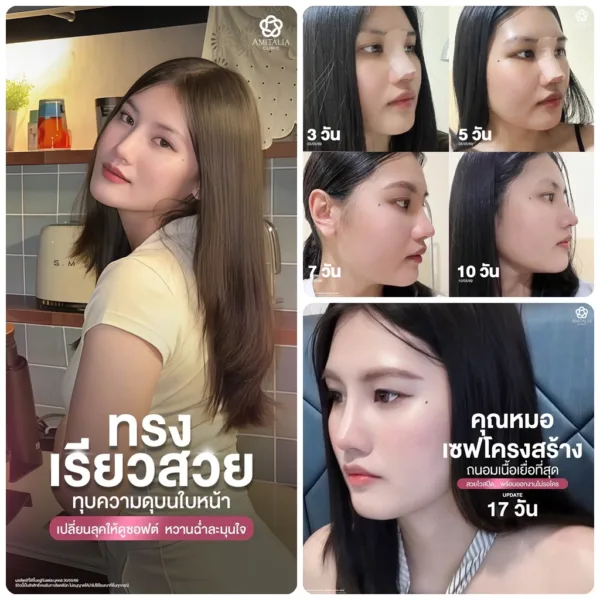 ใบหน้าดูแข็ง