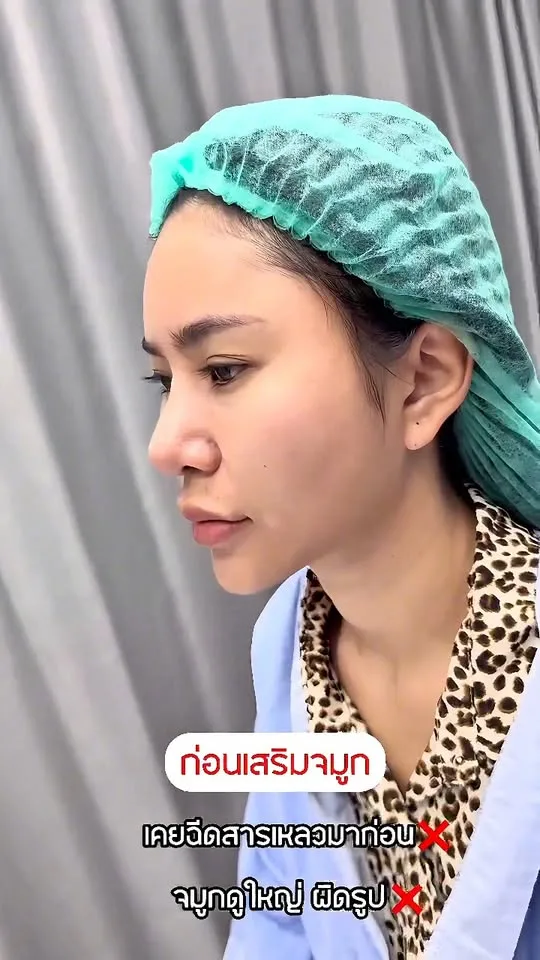 รีวิวแก้จมูก