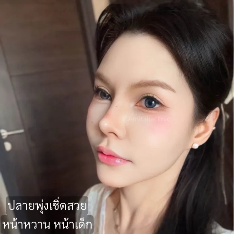 รีวิวแก้จมูก
